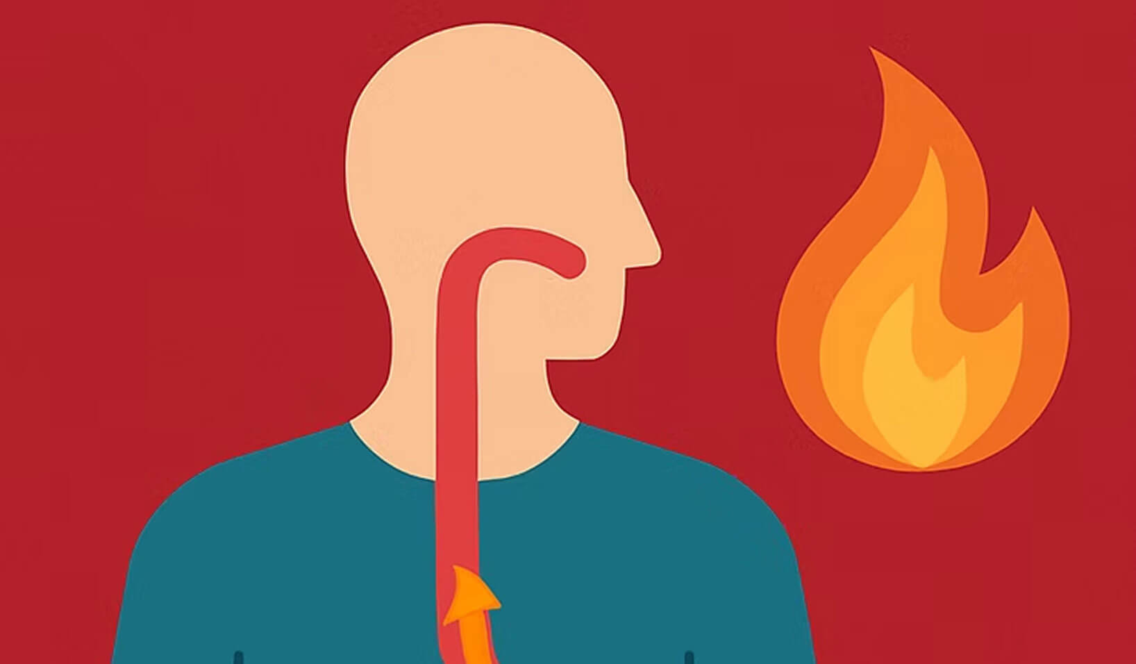 Does Medical Marijuana Help Acid Reflux?